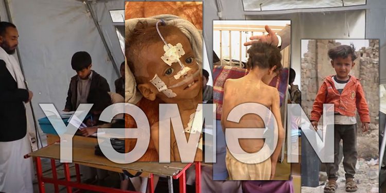 7 ildir Səudiyyə koalisiyası və ABŞ yəmənli körpələri qətliam edir! – Video